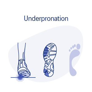 Underpronation