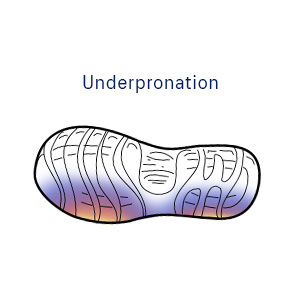 Underpronation